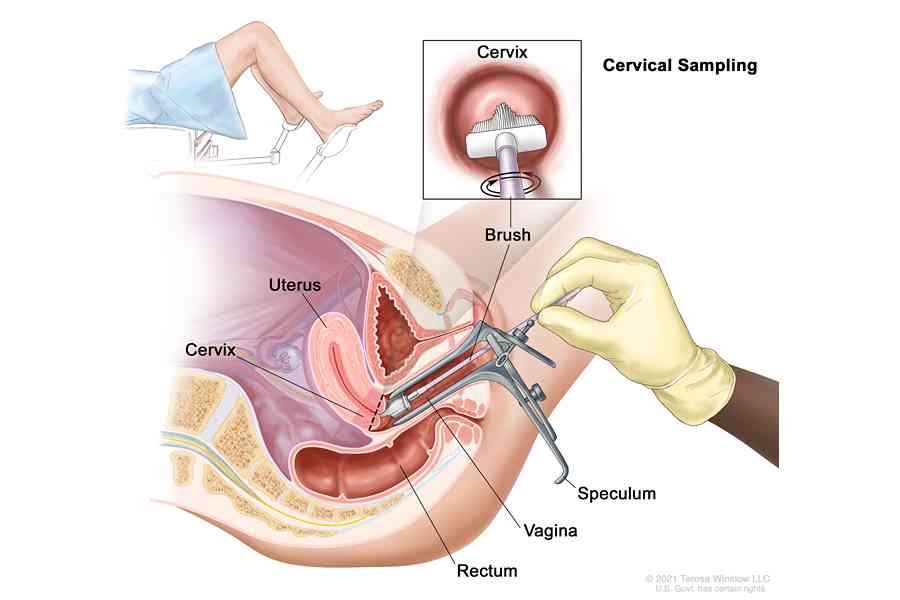 Cervical sampling