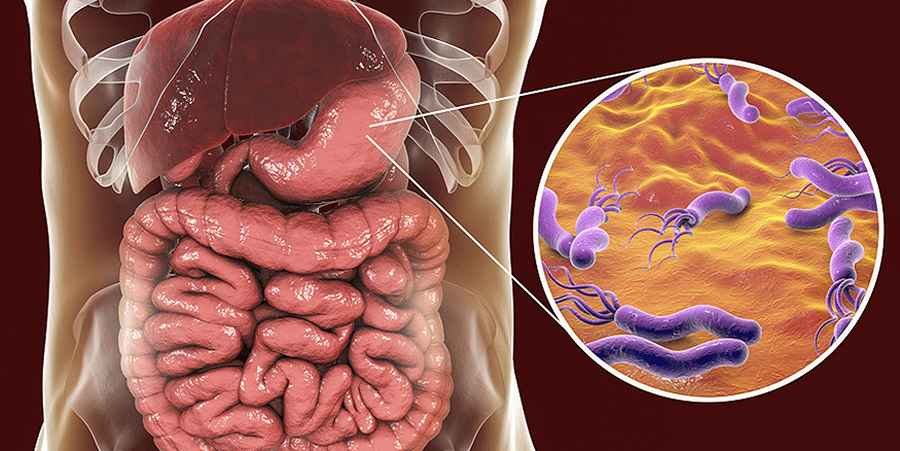 Diagram of helicobacter pylori in the stomach