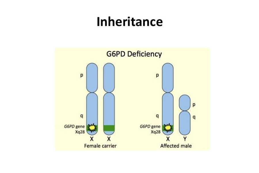 G6PD Deficiency Inheritance