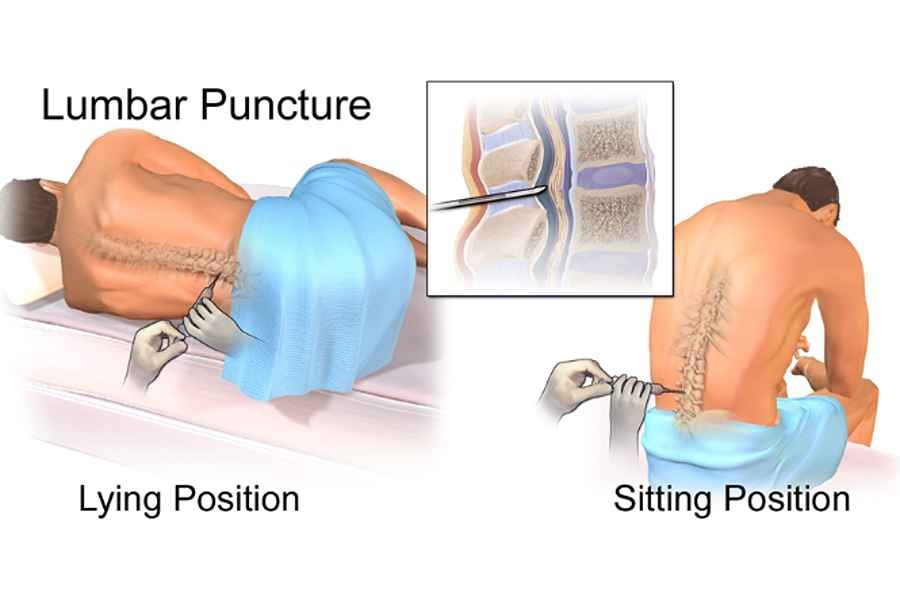 Lumbar puncture positioning