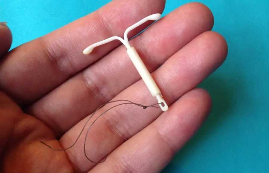 Image of an IUD