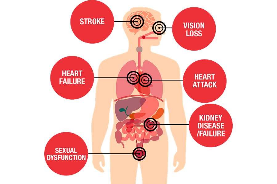 Complications of hypertension