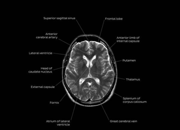 Readin Mri MRI: Why you need it & what to expect before, during, and after ...